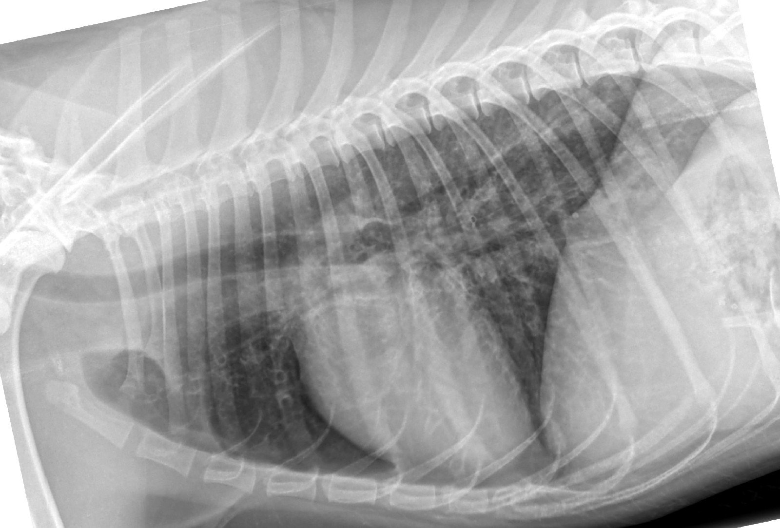 Бронхопневмония фото