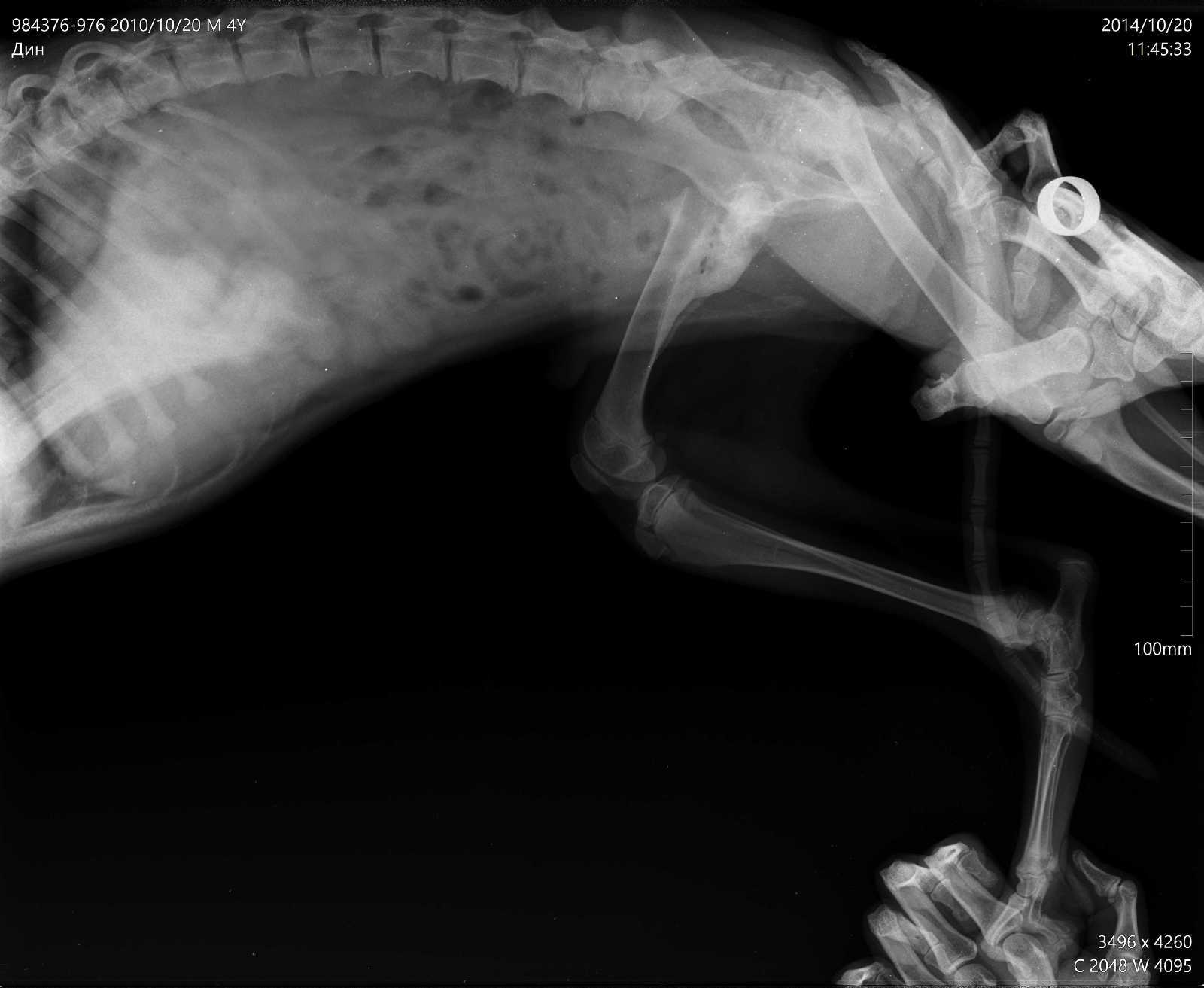 Кальве—Легга—Пертеса синдром фото