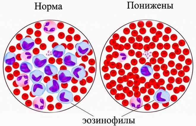Эозинофилы в общем анализе крови кошек и собак. Лейкоцитарная формула - ВЦ  «Зоовет»