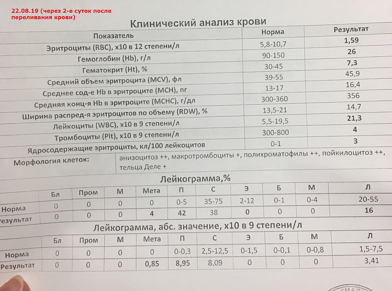 Эритропоэтин анализ