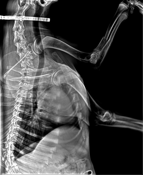 Фтизиатор или фтизиатр кто это. Как правильно писать рентген или рентген. Ренген лёгких результат. Пневмония рентген описание. Расшифровка рентгена легких при пневмонии.