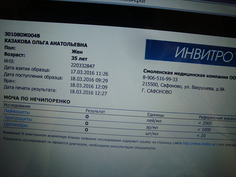 Инвитро каменск уральский телефон. Нечипоренко инвитро. Анализ по Нечипоренко инвитро. Анализ мочи по Нечипоренко инвитро. Проба мочи Сулковича.