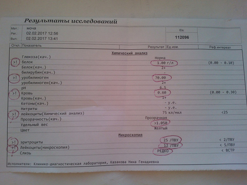 Пиелонефрит общий анализ