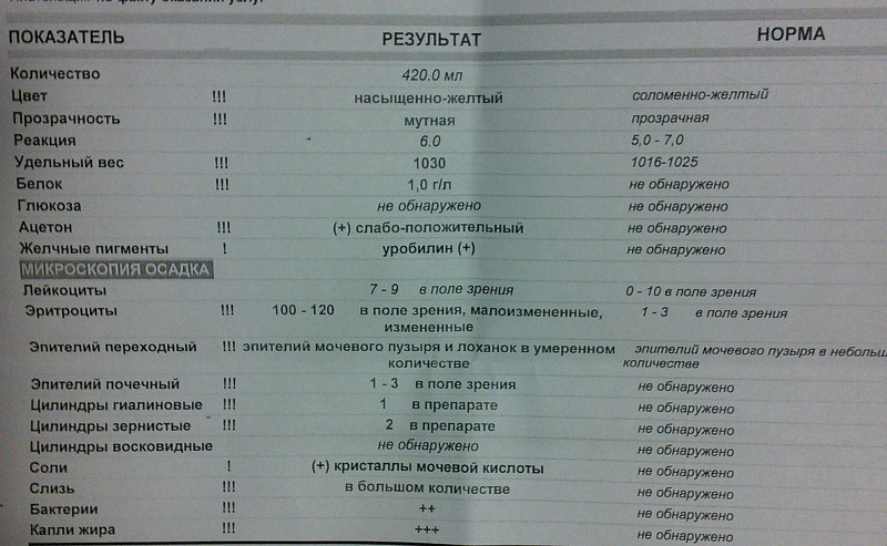 Анализ мочи реакция кислая. Показатели микроскопического исследования мочи в норме. Микроскопическое исследование мочи норма у женщин. Анализ мочи общий белок 1.00+. Белок в моче анализ мочи.