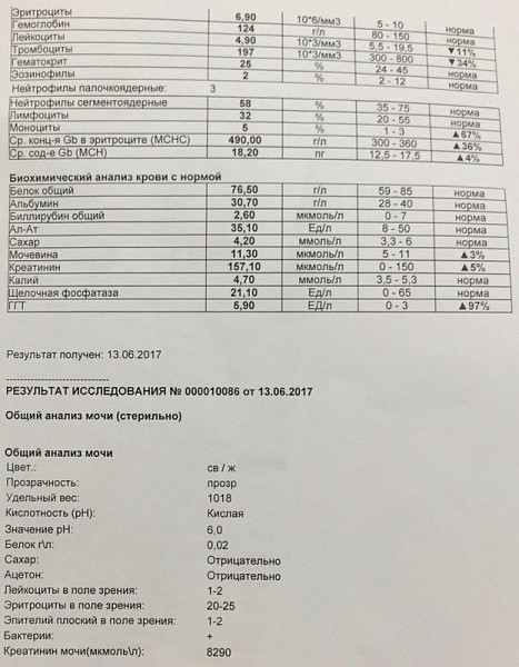 Сколько эритроцитов в моче. Эритроциты в моче 002. Эритроциты в моче 1-1-0. Эритроциты в моче у ребенка норма. Эритроциты в моче у ребенка 0-1-0.