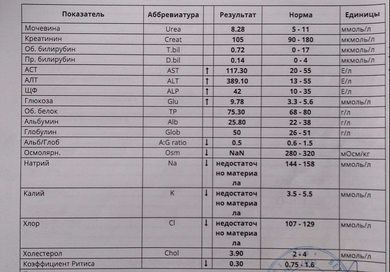 Повышен креатинин в крови что делать. Анализ крови креатинин норма. Мочевина и креатинин в крови норма. Креатин норма у женщин в крови расшифровка у взрослых. Биохимический анализ крови креатин норма.