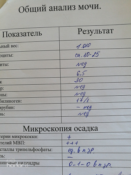 Анализ мочи норма у мужчин по возрасту. Общий анализ мочи норма таблица. Общий анализ мочи показатели нормы у женщин. Общий анализ мочи PH норма у женщин. Общий анализ мочи показатели нормы у мужчин.