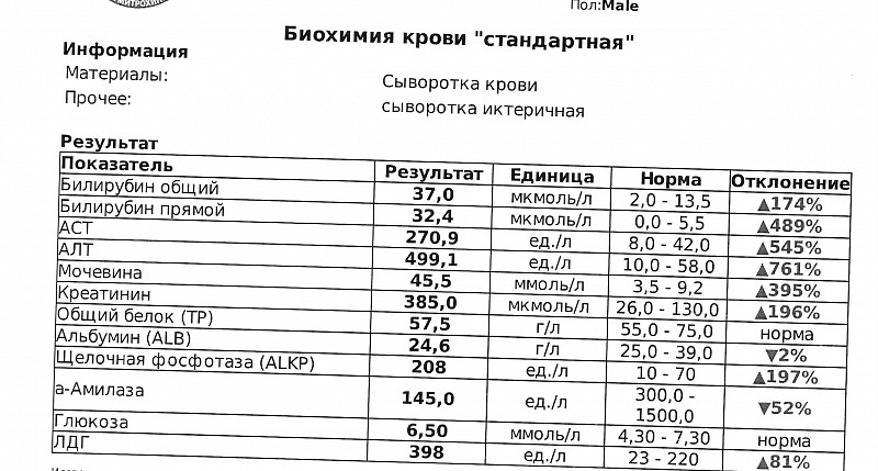 Креатинин сколько норма. Биохимический анализ крови креатинин норма. Норма креатинина в биохимии крови. Норма креатинина в анализе биохимии кровь. Биохимический анализ крови креатинин норма у женщин.