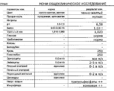 Сколько держатся следы. Период выведения наркотиков из мочи. Анализ мочи на наркотики. Анализ мочи на марихуану.