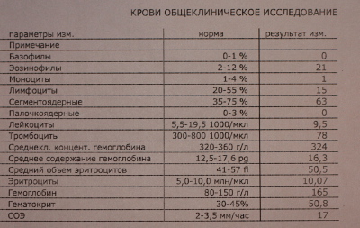 Показатель тромбоза. Показатели анализы при тромбозе. Показатели крови при тромбозе. Тромбоз общий анализ крови показатели. Анализ крови при тромбозе показатели.