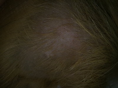 Залысины у морской свинки. Алопеция у морских свинок. Выпадает шерсть у свинки. Беременность морской свинки. Выпадение шерсти у морских свинок.