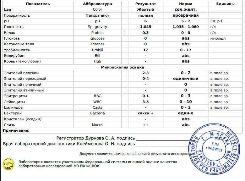 Белок в моче значения